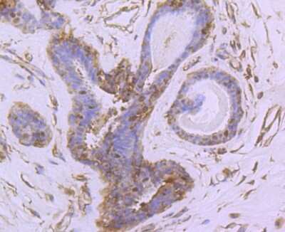 Immunohistochemistry-Paraffin: NGFI-B alpha/Nur77/NR4A1 Antibody (JM59-11) [NBP2-66980] - Analysis of paraffin-embedded human breast tissue using anti-NUR77 antibody. Counter stained with hematoxylin.