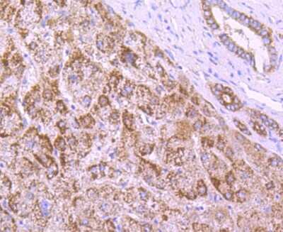 Immunohistochemistry-Paraffin: NGFI-B alpha/Nur77/NR4A1 Antibody (JM59-11) [NBP2-66980] - Analysis of paraffin-embedded human liver tissue using anti-NUR77 antibody. Counter stained with hematoxylin.