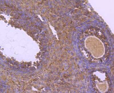 Immunohistochemistry-Paraffin: NGFI-B alpha/Nur77/NR4A1 Antibody (JM59-11) [NBP2-66980] - Analysis of paraffin-embedded mouse ovarian using anti-NUR77 antibody. Counter stained with hematoxylin.