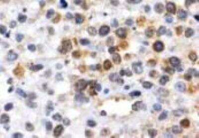 Immunohistochemistry-Paraffin: NGFI-B alpha/Nur77/NR4A1 Antibody (JM59-11) [NBP2-66980] - Human lymph node tissue stained with NGFI-B alpha/Nur77/NR4A1 Antibody (JM59-11). IHC-P image submitted by a verified customer review.