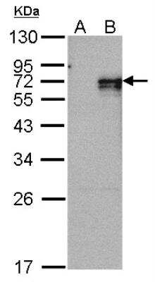 Western Blot: NGFI-B alpha/Nur77/NR4A1 Antibody [NBP2-19613] - Western Blot analysis of NR4A1 expression in transfected 293T cell line by NR4A1 polyclonal antibody. A: Non-transfected lysate. B: NR4A1 transfected lysate. 12% SDS PAGE gel, diluted at 1:500.