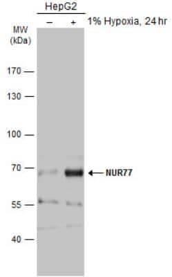 Western Blot: NGFI-B alpha/Nur77/NR4A1 Antibody [NBP2-19613] - Untreated (-) and treated (+) HepG2 whole cell extracts (30 ug) were separated by 7.5% SDS-PAGE, and the membrane was blotted with NUR77 antibody diluted at 1:500. The HRP-conjugated anti-rabbit IgG antibody (NBP2-19301) was used to detect the primary antibody.