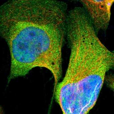 Immunocytochemistry/Immunofluorescence: NGFR/TNFRSF16/p75NTR Antibody [NBP1-85769] - Immunofluorescent staining of human cell line U-2 OS shows localization to nucleoplasm & plasma membrane. Antibody staining is shown in green.