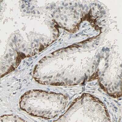 Immunohistochemistry-Paraffin: NGFR/TNFRSF16/p75NTR Antibody [NBP1-85769] - Staining of human prostate shows moderate cytoplasmic positivity in glandular cells.