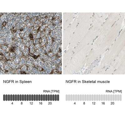 Immunohistochemistry-Paraffin: NGFR/TNFRSF16/p75NTR Antibody [NBP1-85769] - Staining in human spleen and skeletal muscle tissues using NBP1-85769 antibody. Corresponding NGFR RNA-seq data are presented for the same tissues.