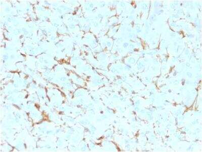 Immunohistochemistry-Paraffin: NGFR/TNFRSF16/p75NTR Antibody (NGFR5) - Azide and BSA Free [NBP2-47965] - Human Adrenal Gland stained with NGFR Mouse Monoclonal Antibody (NGFR5).