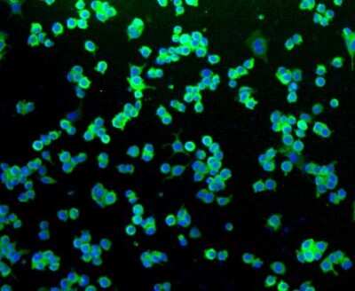 Immunocytochemistry/Immunofluorescence: NGFR/TNFRSF16/p75NTR Antibody (SA39-02) [NBP2-67296] - Staining NGFR p75 in N2A cells (green). The nuclear counter stain is DAPI (blue). Cells were fixed in paraformaldehyde, permeabilised with 0.25% Triton X100/PBS.