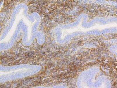 Immunohistochemistry-Paraffin: NGFR/TNFRSF16/p75NTR Antibody (SA39-02) [NBP2-67296] - Human uterus tissue using anti-p75 NGF Receptor antibody. The section was pre-treated using heat mediated antigen retrieval with Tris-EDTA buffer (pH 8.0-8.4) for 20 minutes.The tissues were blocked in 5% BSA for 30 minutes at room temperature, washed with ddH2O and PBS, and then probed with the primary antibody (1/50) for 30 minutes at room temperature. The detection was performed using an HRP conjugated compact polymer system. DAB was used as the chromogen. Tissues were counterstained with hematoxylin and mounted with DPX.