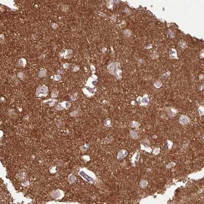 Immunohistochemistry-Paraffin: NGL-1/LRRC4C Antibody [NBP2-49001] - Staining of human cerebral cortex shows strong cytoplasmic positivity in neuropil.