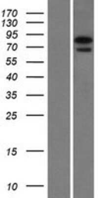 Western Blot: NGLY1 Overexpression Lysate (Adult Normal) [NBL1-13637] Left-Empty vector transfected control cell lysate (HEK293 cell lysate); Right -Over-expression Lysate for NGLY1.