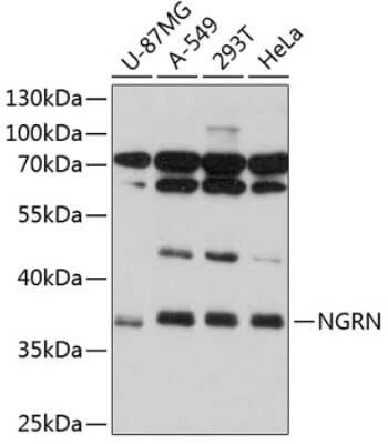 Western Blot: NGRN Antibody [NBP2-93811] - Analysis of extracts of various cell lines, using NGRN at 1:1000 dilution.Secondary antibody: HRP Goat Anti-Rabbit IgG (H+L) at 1:10000 dilution.Lysates/proteins: 25ug per lane.Blocking buffer: 3% nonfat dry milk in TBST.Detection: ECL Basic Kit .Exposure time: 30s.
