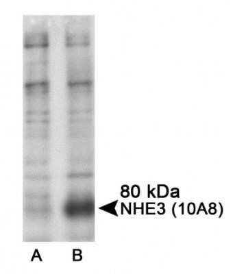 Western Blot: NHE3/SLC9A3 Antibody (10A8) - Azide and BSA Free [NBP2-80876] - Detection of phospho Ser605 in transfected COS-7 cells using NB110-74678. A. untreated B. forskolin and IBMX treated. Image from the standard format of this antibody.