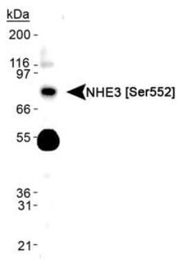 Western Blot: NHE3/SLC9A3 Antibody (14D5) - Azide and BSA Free [NBP2-80877] - Detection of NHE3 [p Ser552] in human kidney lysate. Image from the standard format of this antibody.