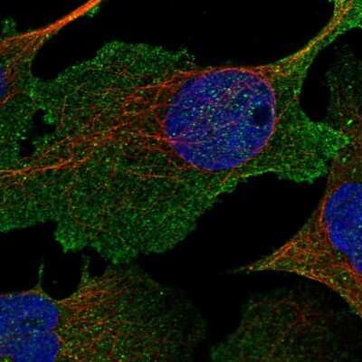 Immunocytochemistry/Immunofluorescence: NHE3/SLC9A3 Antibody [NBP1-82575] - Staining of human cell line U-2 OS shows localization to plasma membrane. Antibody staining is shown in green.