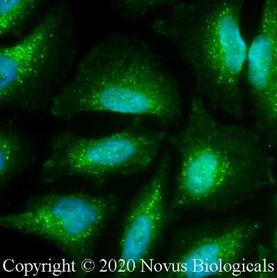 Immunocytochemistry/Immunofluorescence: NHE3/SLC9A3 Antibody [NBP3-00589] - HeLa cells were fixed for 10 minutes using 10% formalin and then permeabilized for 5 minutes using 1X PBS + 0.05% Triton-X100. The cells were incubated with anti-NHE3/SLC9A3 at 5 ug/ml overnight at 4C and detected with an anti-rabbit Dylight 488 (Green) at a 1:500 dilution. Nuclei were counterstained with DAPI (Blue). Cells were imaged using a 40X objective. 