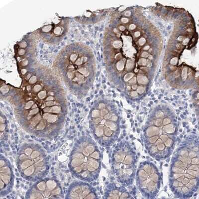 Immunohistochemistry-Paraffin: NHE3/SLC9A3 Antibody [NBP1-82575] - Staining of human colon shows high expression.