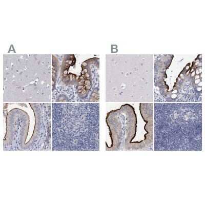 Immunohistochemistry-Paraffin: NHE3/SLC9A3 Antibody [NBP1-82575] - Staining of human cerebral cortex, colon, gallbladder and lymph node using Anti-SLC9A3 antibody NBP1-82575 (A) shows similar protein distribution across tissues to independent antibody NBP1-82574 (B).