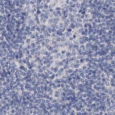 Immunohistochemistry-Paraffin: NHE3/SLC9A3 Antibody [NBP1-82575] - Staining of human lymph node.