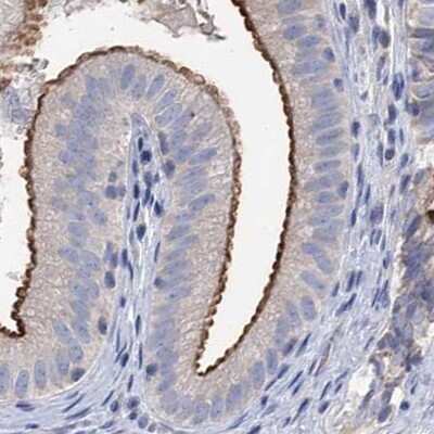 Immunohistochemistry-Paraffin: NHE3/SLC9A3 Antibody [NBP1-82575] - Staining of human gallbladder.