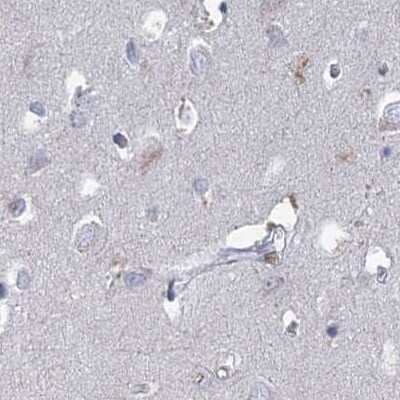 Immunohistochemistry-Paraffin: NHE3/SLC9A3 Antibody [NBP1-82575] - Staining of human cerebral cortex.