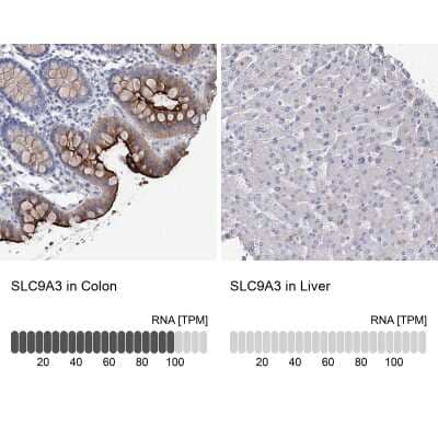 Immunohistochemistry-Paraffin: NHE3/SLC9A3 Antibody [NBP1-82575] - Analysis in human colon and liver tissues using NBP1-82575 antibody. Corresponding SLC9A3 RNA-seq data are presented for the same tissues.