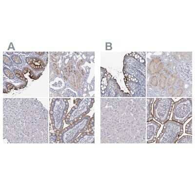 Immunohistochemistry-Paraffin: NHE3/SLC9A3 Antibody [NBP1-82575] - Staining of human colon, kidney, liver and small intestine using Anti-SLC9A3 antibody NBP1-82575 (A) shows similar protein distribution across tissues to independent antibody NBP1-82574 (B).