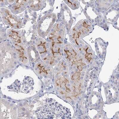 Immunohistochemistry-Paraffin: NHE3/SLC9A3 Antibody [NBP1-82575] - Staining of human kidney shows moderate positivity in apical membrane in cells in tubules.