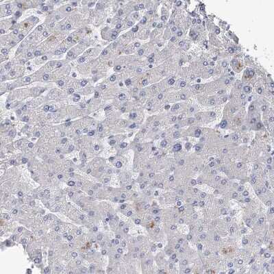 Immunohistochemistry-Paraffin: NHE3/SLC9A3 Antibody [NBP1-82575] - Staining of human liver shows no membranous positivity in hepatocytes as expected.