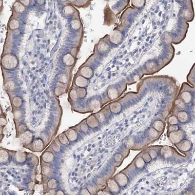 Immunohistochemistry-Paraffin: NHE3/SLC9A3 Antibody [NBP1-82575] - Staining of human small intestine shows moderate positivity in apical membrane in glandular cells.