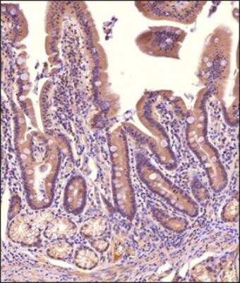 Immunohistochemistry-Paraffin: NHE3/SLC9A3 Antibody [NBP3-00589] -  Analysis of a FFPE tissue section of human small intestine using 1:200 dilution of NHE3 antibody. The staining was developed using HRP labeled anti-rabbit secondary antibody and DAB reagent, and nuclei of cells were counter-stained with hematoxylin. This NHE3 antibody generated nuclear staining.