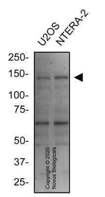 Western Blot: NHE3/SLC9A3 Antibody [NBP3-00589] - Total protein from human Hek293 and HeLa cells was separated on a 7.5% gel by SDS-PAGE, transferred to PVDF membrane and blocked in 5% non-fat milk in TBST. The membrane was probed with 2.0 ug/ml anti-NHE3 (NBP3-00589) in blocking buffer and detected with an anti-rabbit HRP secondary antibody using NovaLume chemiluminescence detection reagent (NPB2-61915).