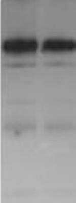 Western Blot: NHE3/SLC9A3 [p Ser605] Antibody (10A8) [HRP] [NB110-74678H] - Mouse enterocytes lysate probed with NHE3/SLC9A3 [HRP] Antibody. WB image submitted by a verified customer review.