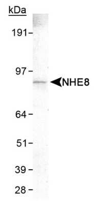 Western Blot: NHE8 Antibody (7A11) - Azide and BSA Free [NBP2-80878] - Detection of NHE8 (7A11) in HeLa whole cell lysate Image from the standard format of this antibody.