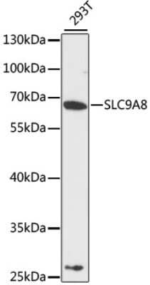 Western Blot: NHE8 Antibody [NBP2-93407] - Analysis of extracts of 293T cells, using NHE8 at 1:3000 dilution.Secondary antibody: HRP Goat Anti-Rabbit IgG (H+L) at 1:10000 dilution.Lysates/proteins: 25ug per lane.Blocking buffer: 3% nonfat dry milk in TBST.Detection: ECL Basic Kit .Exposure time: 9