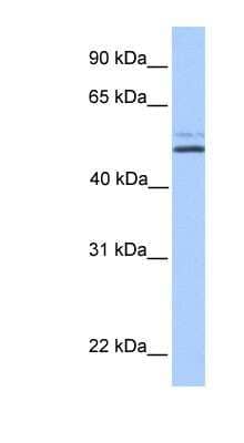 Western Blot: NHA2/SLC9B2/NHEDC2 Antibody [NBP1-59579] - NHEDC2 Antibody [NBP1-59579] - NTERA2 cell lysate, concentration 0.2-1 ug/ml.