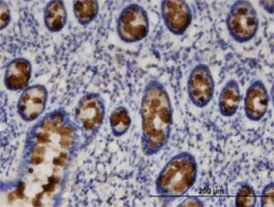 Immunohistochemistry-Paraffin: NHERF-1 Antibody (2B7) [H00009368-M02] - Analysis of monoclonal antibody to SLC9A3R1 on formalin-fixed paraffin-embedded human small Intestine. Antibody concentration 3 ug/ml.