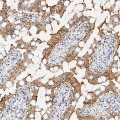 Immunohistochemistry-Paraffin: NHERF-1 Antibody [NBP1-84918] - Staining of human small intestine shows high expression.