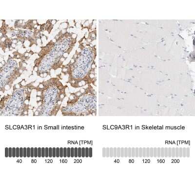 <b>Orthogonal Strategies Validation. </b>Immunohistochemistry-Paraffin: NHERF-1 Antibody [NBP1-84918] - Staining in human small intestine and skeletal muscle tissues using anti-SLC9A3R1 antibody. Corresponding SLC9A3R1 RNA-seq data are presented for the same tissues.