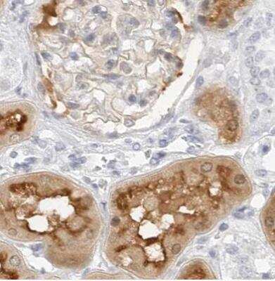 Immunohistochemistry-Paraffin: NHERF-1 Antibody [NBP1-84918] - Staining of human kidney using Anti-SLC9A3R1 antibody.