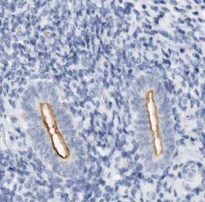 Immunohistochemistry-Paraffin: NHERF-1 Antibody [NBP1-84918] - Staining of human endometrium using Anti-SLC9A3R1 antibody.