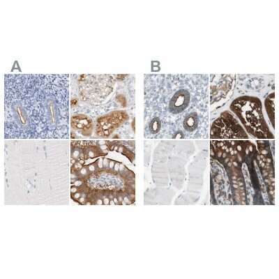 <b>Independent Antibodies Validation. </b>Immunohistochemistry-Paraffin: NHERF-1 Antibody [NBP1-84918] - Staining of human endometrium, kidney, skeletal muscle and small intestine using Anti-SLC9A3R1 antibody NBP1-84918 (A) shows similar protein distribution across tissues to independent antibody NBP1-84919 (B).