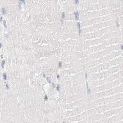 Immunohistochemistry-Paraffin: NHERF-1 Antibody [NBP1-84918] - Staining of human skeletal muscle using Anti-SLC9A3R1 antibody NBP1-84918.