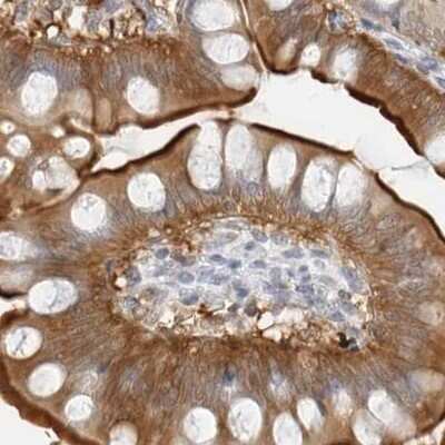 Immunohistochemistry-Paraffin: NHERF-1 Antibody [NBP1-84918] - Staining of human small intestine using Anti-SLC9A3R1 antibody NBP1-84918.