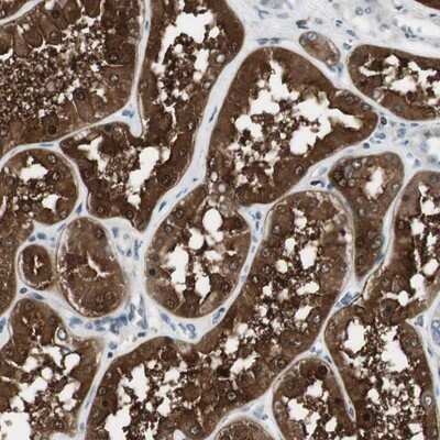 Immunohistochemistry-Paraffin: NHERF-1 Antibody [NBP1-84919] - Staining of human kidney shows strong cytoplasmic positivity in cells of tubules.