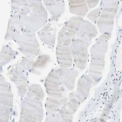 Immunohistochemistry-Paraffin: NHERF-1 Antibody [NBP1-84919] - Staining of human skeletal muscle shows low expression as expected.