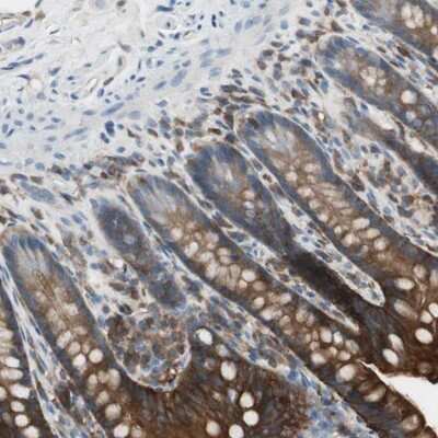 Immunohistochemistry-Paraffin: NHERF-1 Antibody [NBP1-84919] - Staining of human small intestine shows high expression.