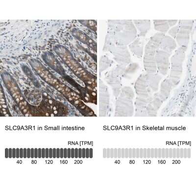 <b>Orthogonal Strategies Validation. </b>Immunohistochemistry-Paraffin: NHERF-1 Antibody [NBP1-84919] - Staining in human small intestine and skeletal muscle tissues using anti-SLC9A3R1 antibody. Corresponding SLC9A3R1 RNA-seq data are presented for the same tissues.