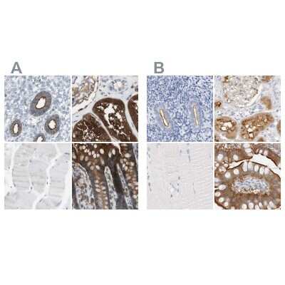 <b>Independent Antibodies Validation. </b>Immunohistochemistry-Paraffin: NHERF-1 Antibody [NBP1-84919] - Staining of human endometrium, kidney, skeletal muscle and small intestine using Anti-SLC9A3R1 antibody NBP1-84919 (A) shows similar protein distribution across tissues to independent antibody NBP1-84918 (B).