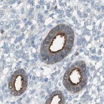 Immunohistochemistry-Paraffin: NHERF-1 Antibody [NBP1-84919] - Staining of human endometrium.