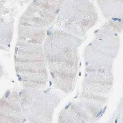 Immunohistochemistry-Paraffin: NHERF-1 Antibody [NBP1-84919] - Staining of human skeletal muscle using Anti-SLC9A3R1 antibody NBP1-84919.